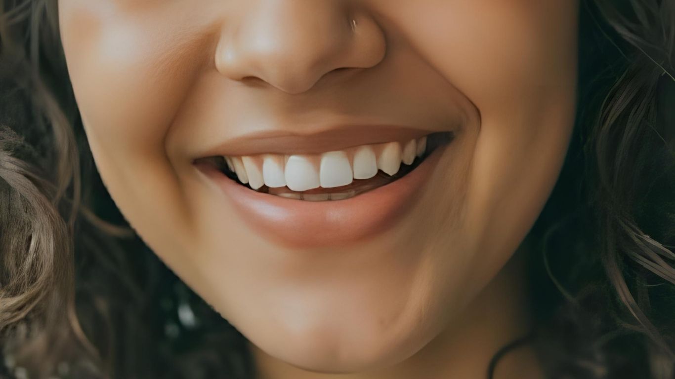 How to Achieve Your Dream Smile with The Smile Bar Camps Bay